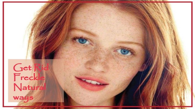 How to Get Rid of Freckles | Zubaida Tariq | Health Tips