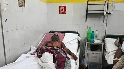 सोते समय दंपत्ति पर अज्ञात दबंगों ने फेंका तेजाब, हालात नाजुक