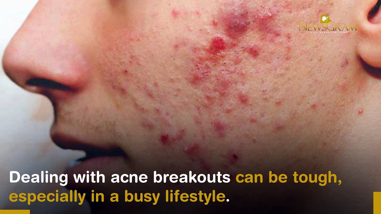 Here Are Ways To Deal With Acne Breakout