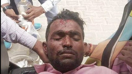 पक्का ताल के पास तेज गति बोलेरो कार ने बाइक को मारी जोरदार टक्कर युवक हुआ घायल