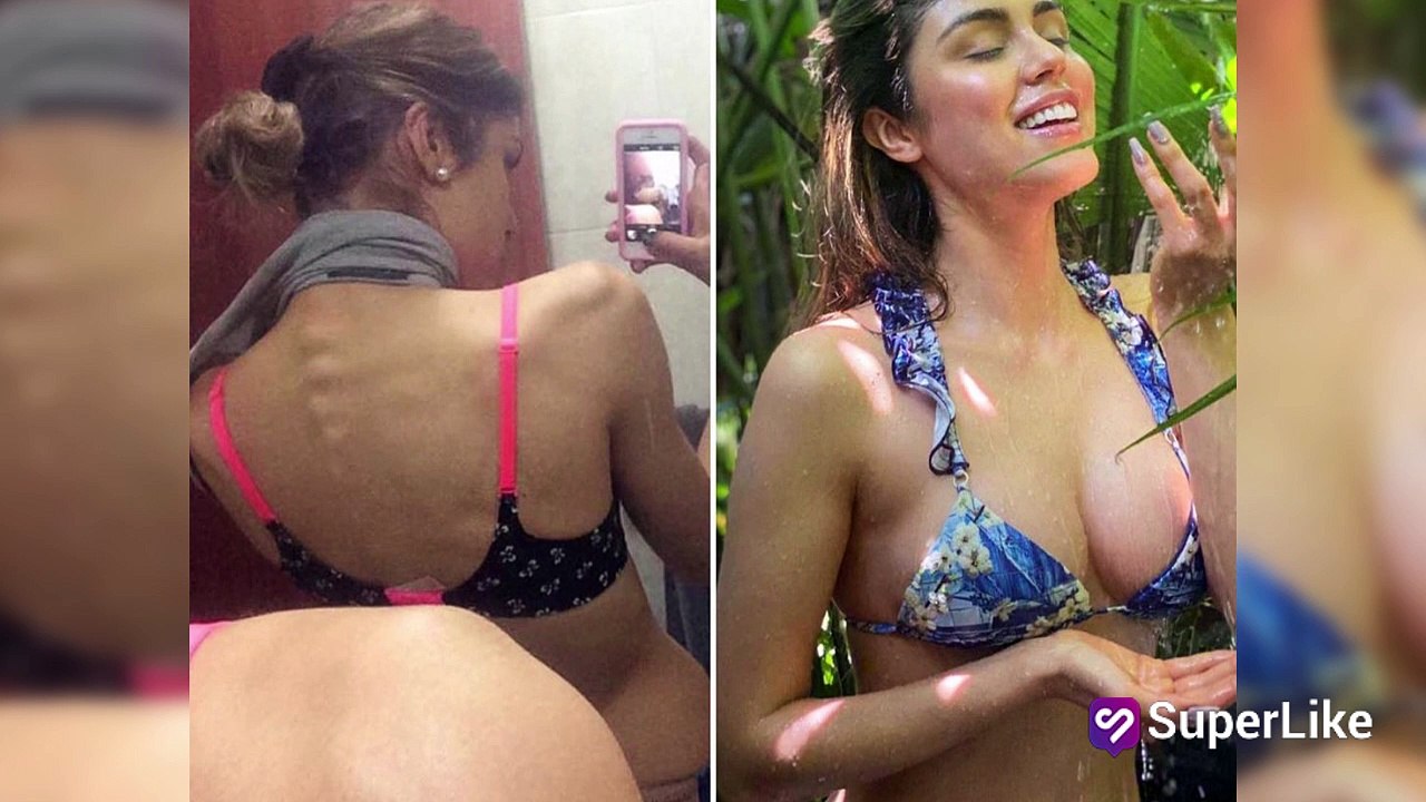 Pautips terminó terapia tras anorexia y contó cómo logró subir de peso
