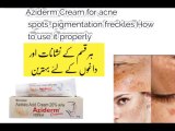 Aziderm Cream | Best Cream for acne spots and pigmentation
