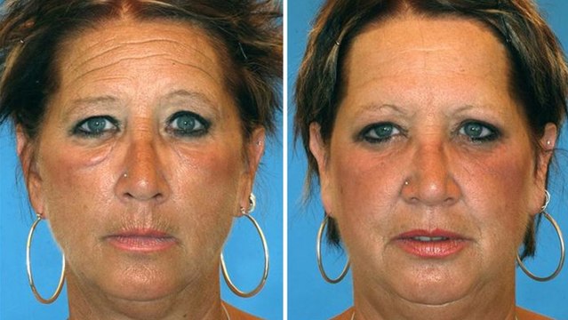 Des fumeurs photographiés aux côtés de leur jumeau non fumeur