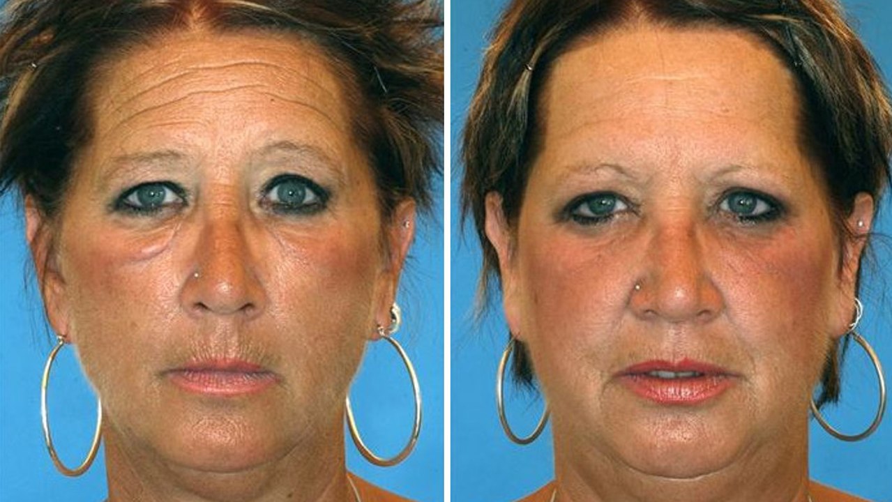 Des fumeurs photographiés aux côtés de leur jumeau non fumeur