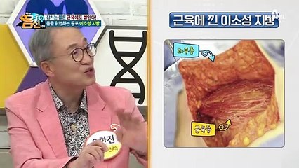더 강력하고 독한 지방! 근육에도 쌓이는 '이소성 지방'