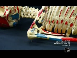 How Its Made - 543 Artificial Joints 2