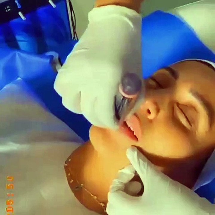 دينا الشربيني تخضع لعملية تجميل: كيف ظهرت؟