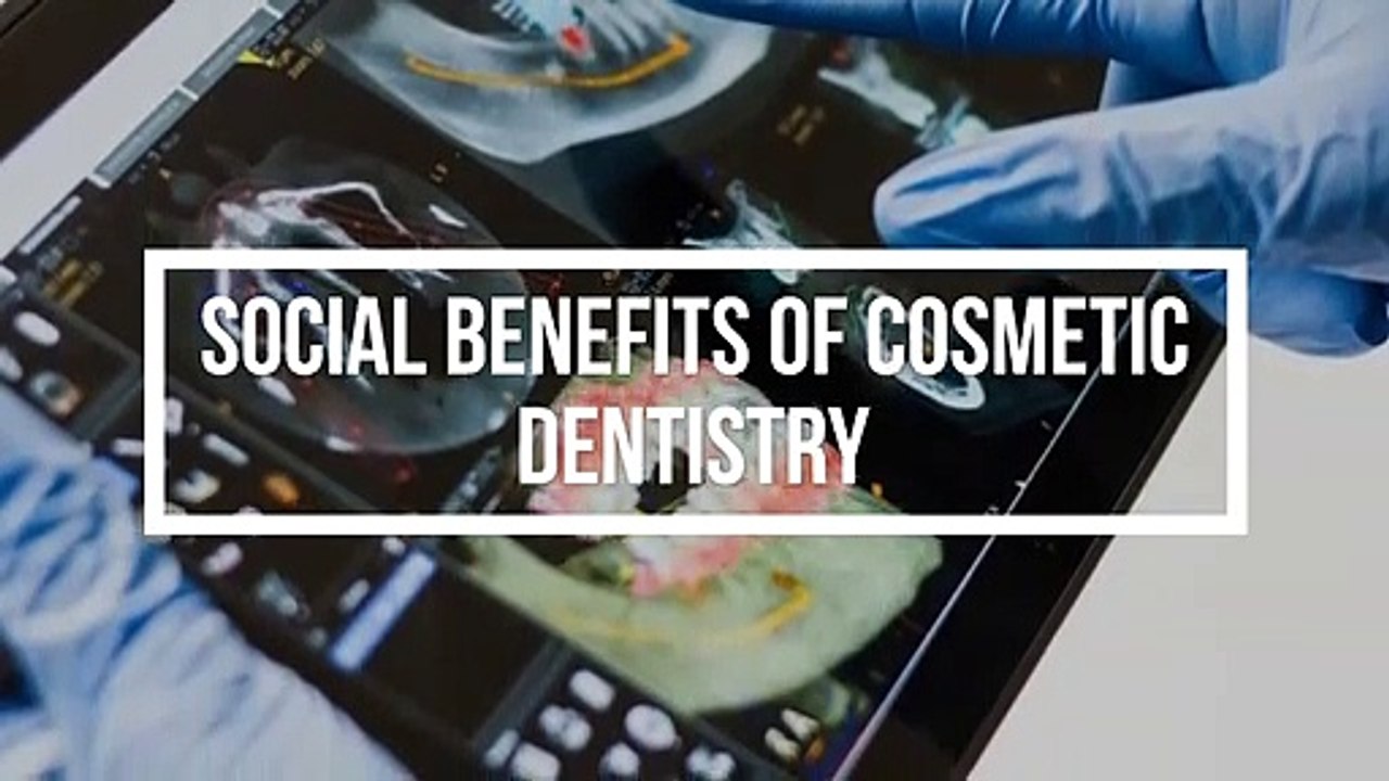 Social Benefits of Cosmetic Dentistry