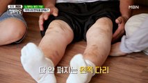 멍이 잘 드는 어머니의 현재 몸상태는?