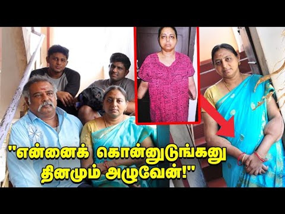 கைமாற்று அறுவை சிகிச்சை Success Story | Life After Accident