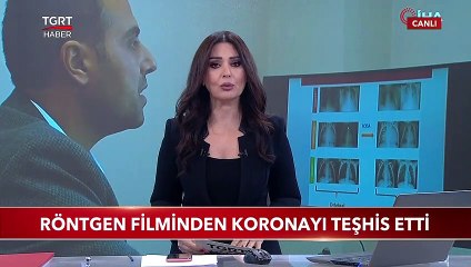 Röntgen Filminden Koronayı Teşhis Etti