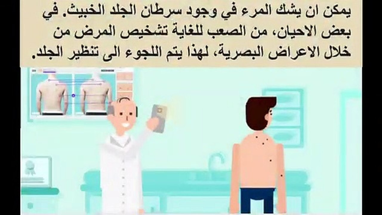 ما هو منظار الجلد او الديرموسكوب ؟ لماذا احتاج الى تنظير الجلد ؟ | dermatoscope |