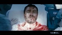 Painless Trailer - Die Wahrheit Ist Schmerzhaft (2013)