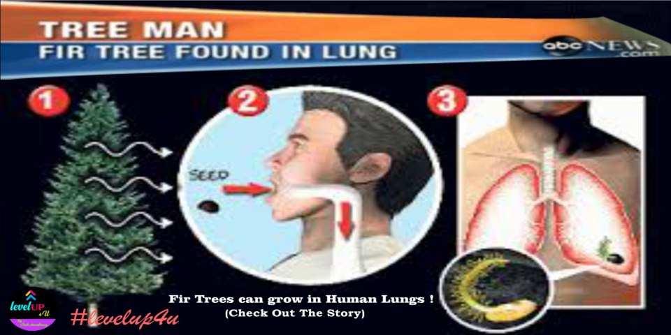 Tree man|Shocked Surgeons Claim|Too Strange to be True| Did fir branch prick a lung|Fact the World| #levelup4u