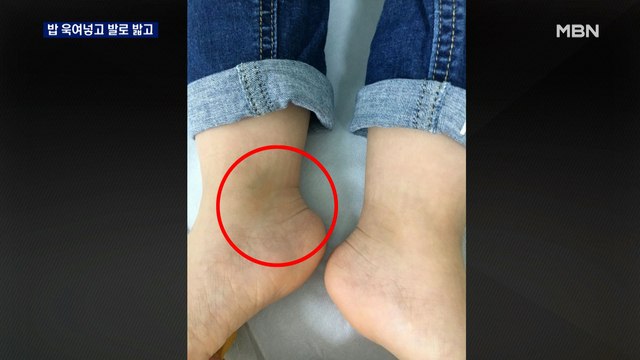 밥 욱여넣고 발로 밟고… 학대 피해 아동 3명 더 있다