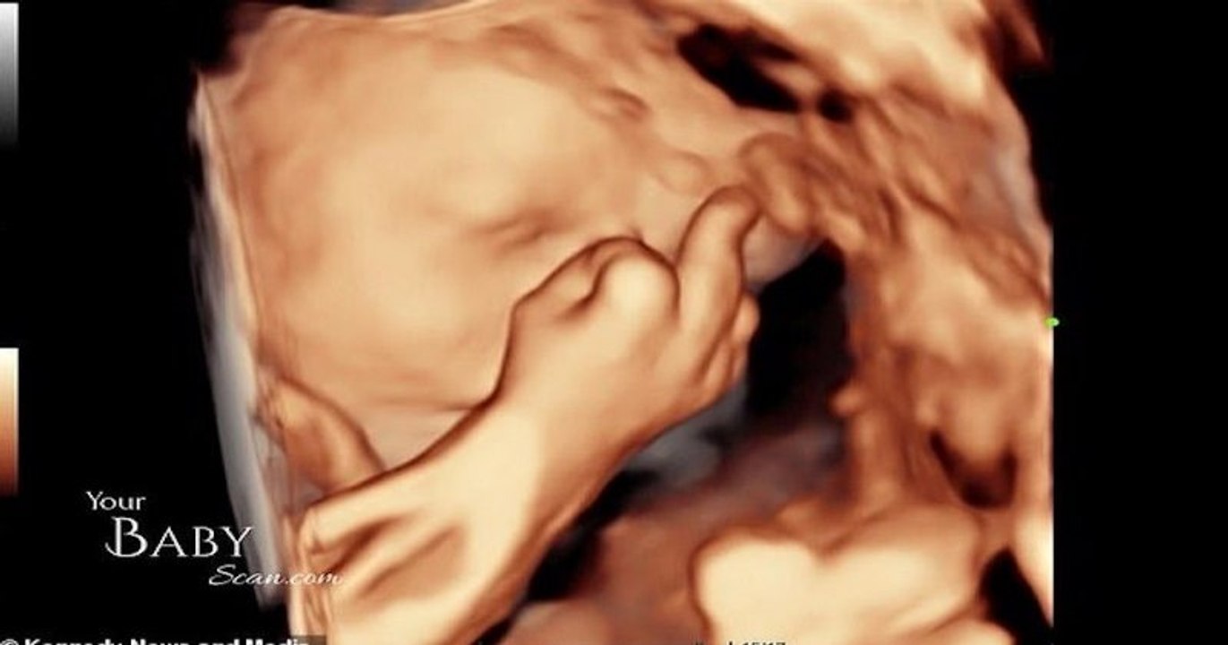 Ce bébé fait un doigt d'honneur sur l'échographie
