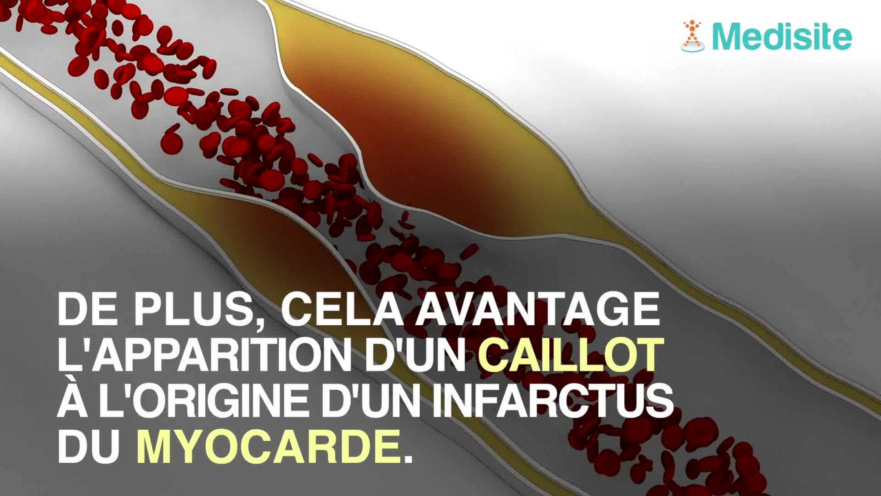 Quels dangers en cas de cholestérol trop élevé ? Vidéo Dailymotion