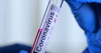 ¿La inmunidad contra el coronavirus disminuye con el tiempo? Estudio encontró nuevas evidencias