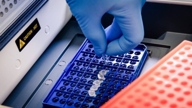 Siguen las quejas: más de 29.000 colombianos han esperado hasta un mes por resultados de pruebas covid