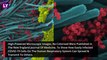 Scientists Publish Images Of Infected Respiratory Cells By Coronavirus; Researchers Show The Intensity Of COVID-19 Infections With New Pictures