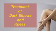 Treatment Of Dark Elbows and Knees |  Zubaida Tariq | Health Tips