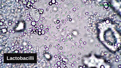 သင့်ခန္ဓာကိုယ် အတွင်းရှိ ဘက်တီးရီးယား အကြောင်း | ThinYuPar