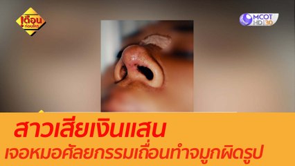 สาวเสียเงินแสนเจอหมอศัลยกรรมเถื่อนทำจมูกผิดรูป : เตือนก่อนใคร (28 ต.ค. 63)