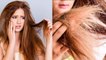 सर्दियों में बाल नहीं होंगे रूखे और बेजान, इन तरीकों से रखें ध्यान | Hair Care Tips | Boldsky