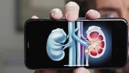 Santé - Tout sur la colique néphrétique