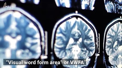 According to a New Study Newborns See Words From Birth