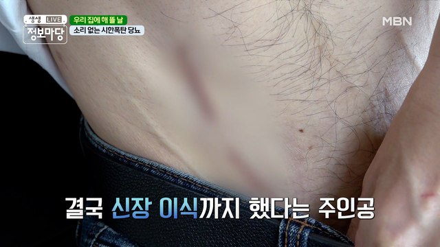 신장 공여자는 바로 아내...! 생명의 은인과 함께 건강 되찾기ღ'ᴗ'ღ
