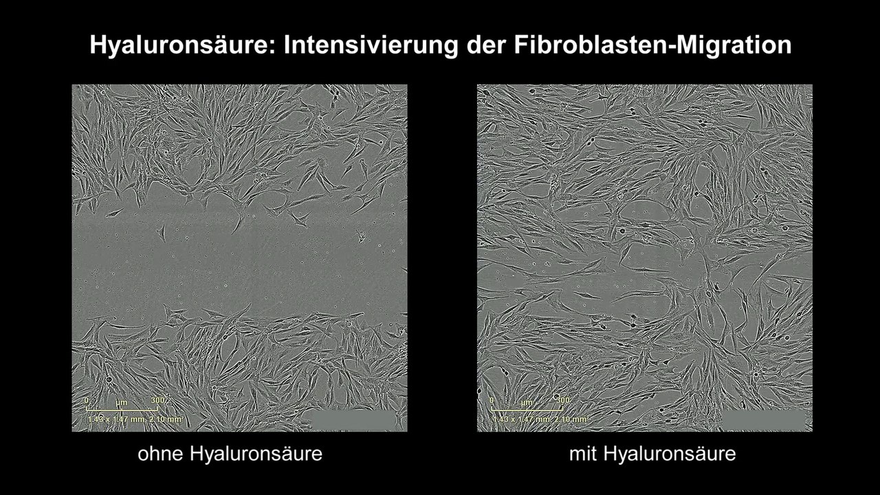 Hyaluronsäure intensiviert Fibroblasten-Migration bei Wundheilung (24-Std.-Zeitraffer)
