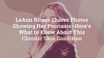 LeAnn Rimes Shares Photos Showing Her Psoriasis–Here's What to Know About This Chronic Ski