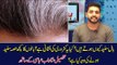 Why our hairs turn grey? Reason of grey hairs with Shadab Abbasi