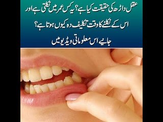 The reality of wisdom tooth. Is it hard to get it evacuated? Details in the video