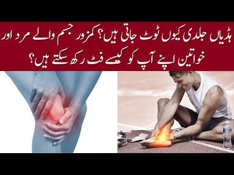 How Bones are Deformed and What is Osteoporosis? How to Keep Your Body Fit? Details in this Video