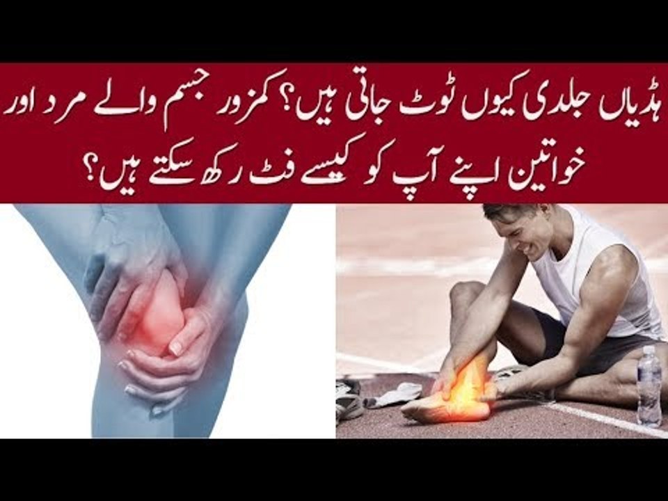 How Bones are Deformed and What is Osteoporosis? How to Keep Your Body Fit? Details in this Video