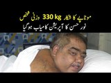 Surgery of 330 KGs Noor Hassan is Successful. How many KGs He Got Relief? Find out more
