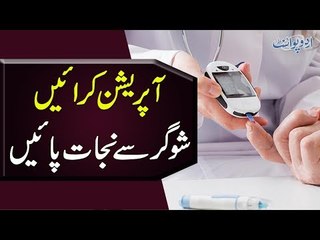 Has Diabetes Stopped Your Life? | The Cure of Sugar is Just One Operation Away Now