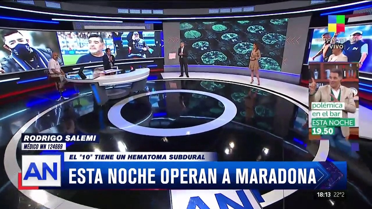 Operan a Maradona: ¿qué es un hematoma subdural?