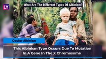 International Albinism Awareness Day 2020: Causes, Types And Diagnosis Of This Genetic Disorder