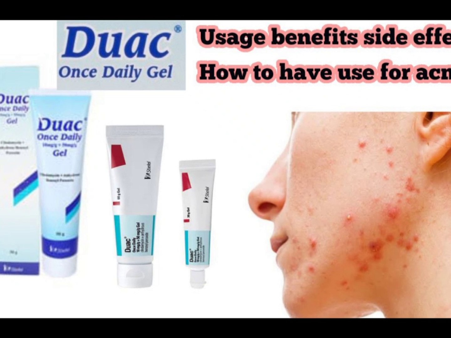 Duac Once Daily Gel | Best treatment for acne and pimples - video  Dailymotion