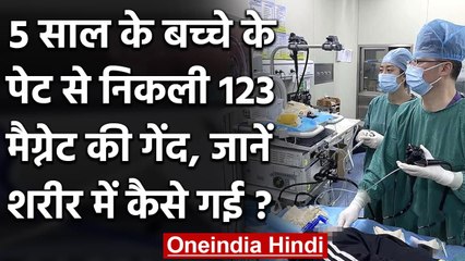 China:5 साल के बच्चे के पेट से निकाली गई 123 Magnetic beads, डॉक्टर भी हुए Shocked| वनइंडिया हिंदी
