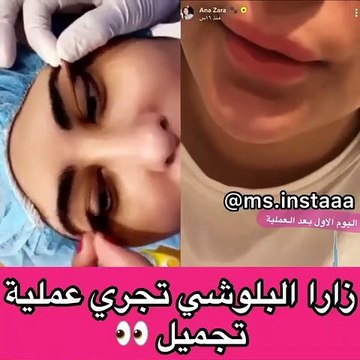 زارا البلوشي تخضع لعملية تجميل جديدة وتفاجئ متابعيها بالنتائج