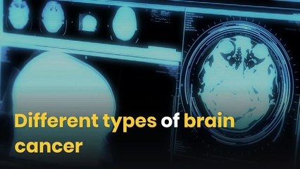 Patty Cordoba | What Are the Different Brain Tumor Types?