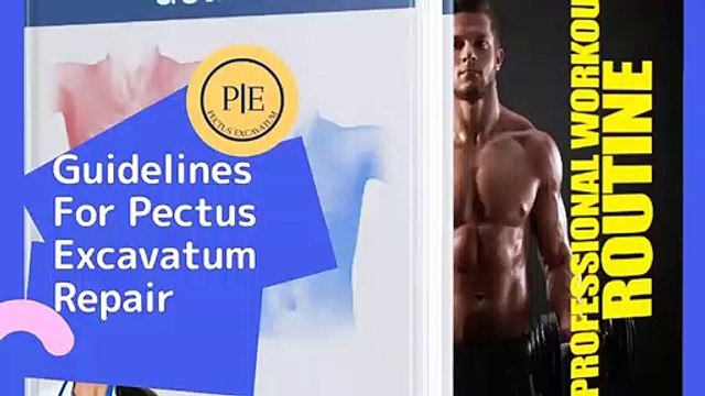 Guidelines For Pectus Excavatum Repair - Pectus Excavatum Guide