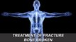 Treatment of Fracture Broken Bone | Health Tips