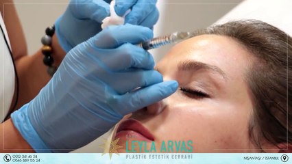 BURUN DOLGUSU YAPTIRMAK