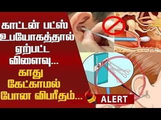 நீங்கள் காதுகளுக்கு பட்ஸ் உபயோகிப்பவரா...உஷார்! #Alert