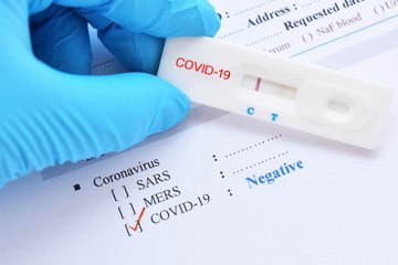 Vous allez voyager en Europe, voilà combien coûte un test PCR dans chaque pays